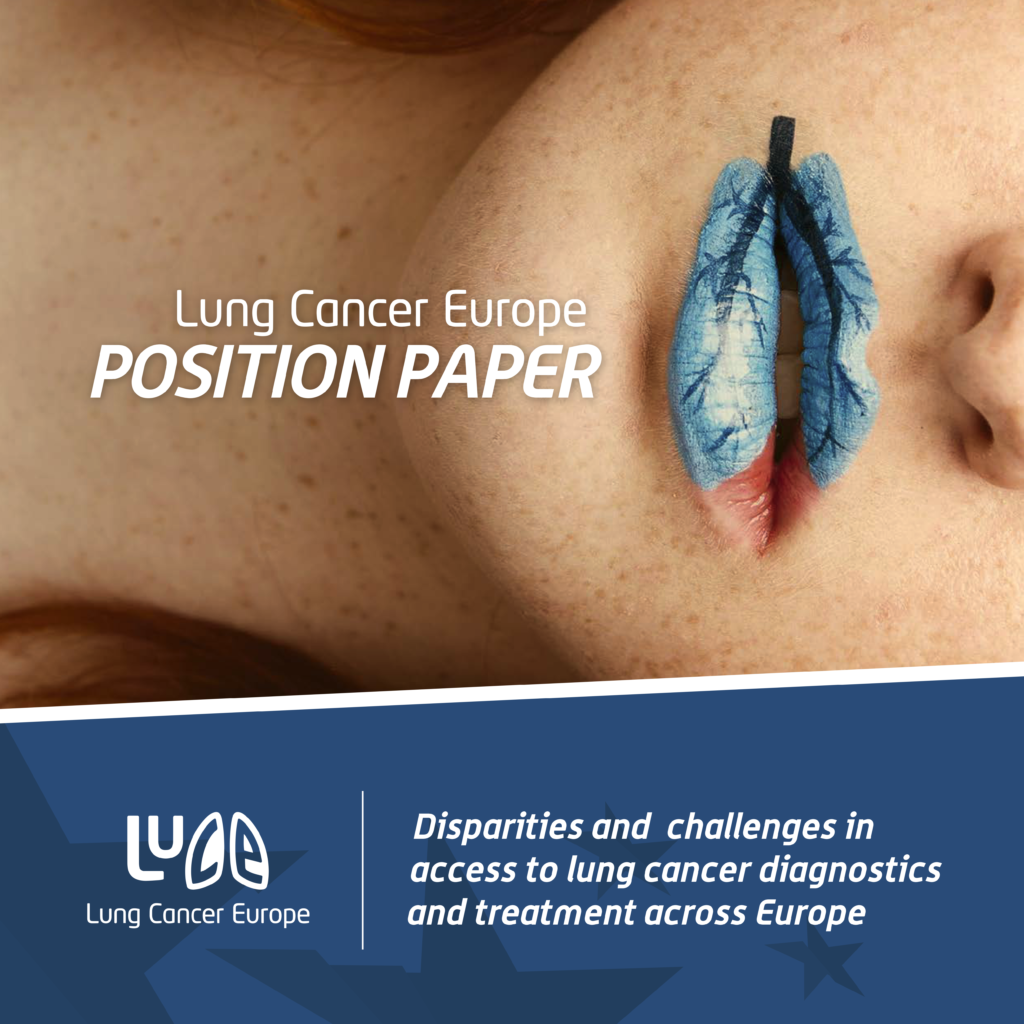 LUNG CANCER EUROPE: 2020 POSITION PAPER. DISPARITIES AND CHALLENGES IN ACCESS TO LUNG CANCER DIAGNOSIS AND TREATMENT ACROSS EUROPE